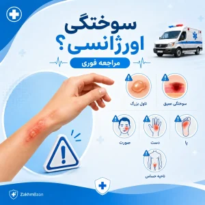 سوختگی اورژانسی