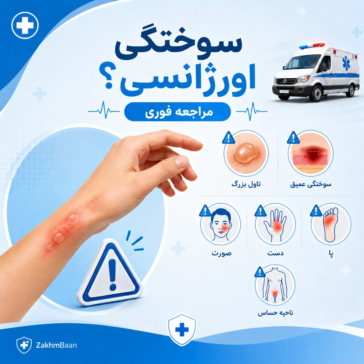 سوختگی اورژانسی