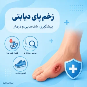 زخم پای دیابتی