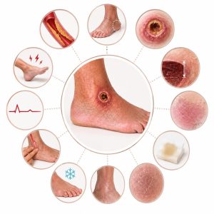 مشخصات ظاهری یک زخم شریانی