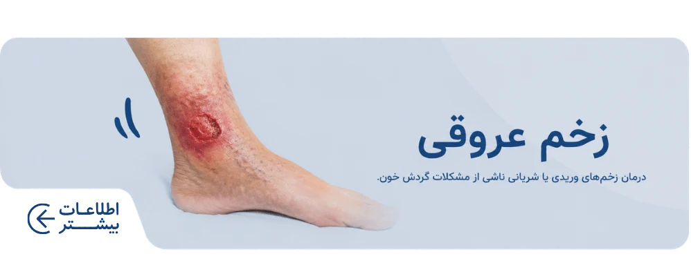 زخم عروقی