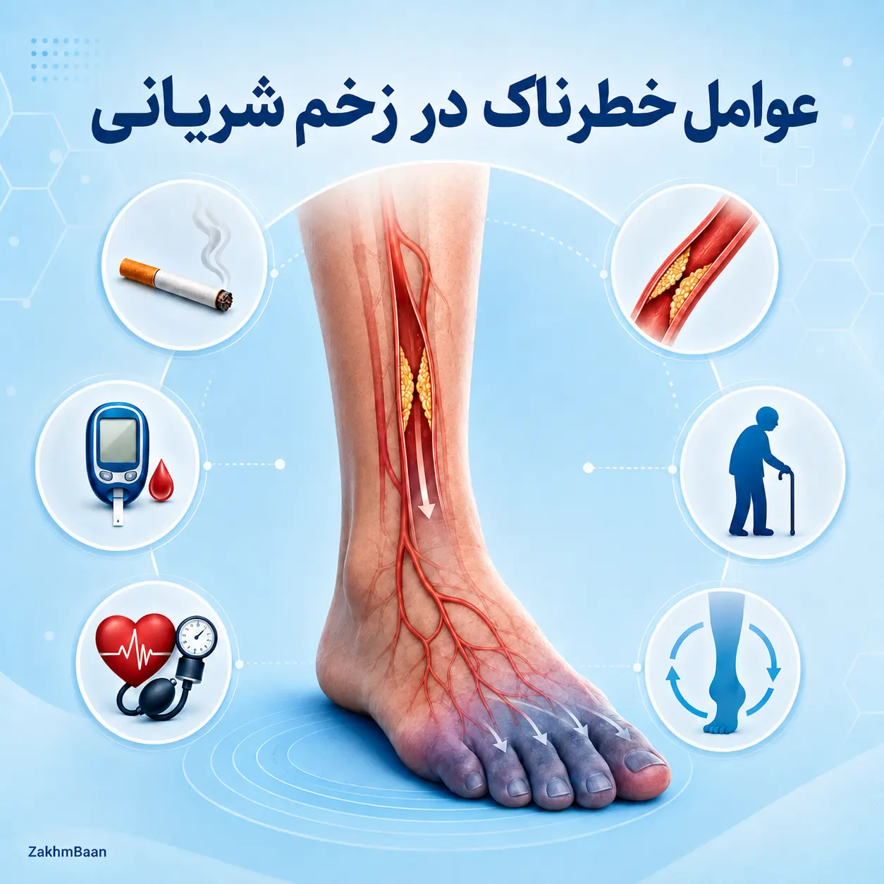 عوامل خطرناک در زخم شریانی