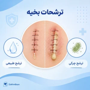 تفاوت بین ترشحات طبیعی (سروما) و ترشحات چرکی (عفونت) از محل بخیه