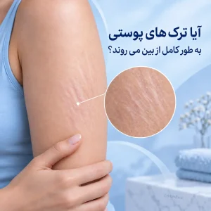 آیا ترک‌های پوستی به طور کامل از بین می‌روند؟