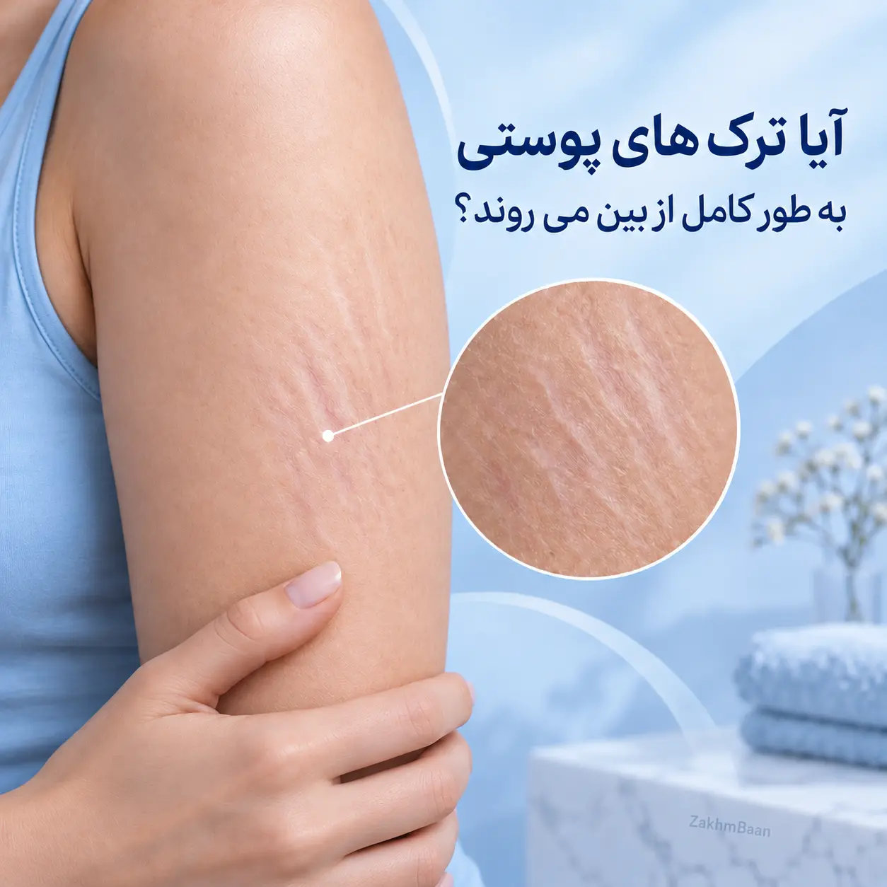 آیا ترک‌های پوستی به طور کامل از بین می‌روند؟