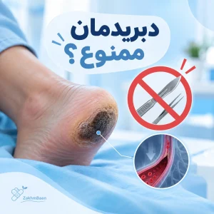 چه زمانی نباید بافت مرده زخم را برداشت