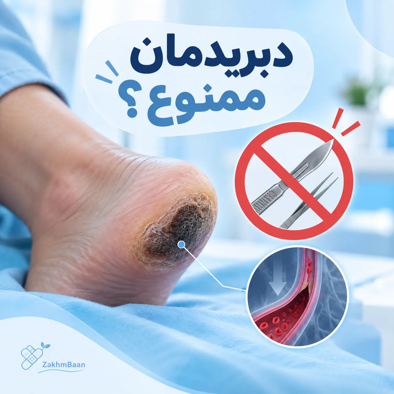 چه زمانی نباید بافت مرده زخم را برداشت